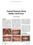 Treatment Planning for Missing Maxillary Lateral Incisors