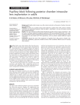 Pupillary block following posterior chamber intraocular lens