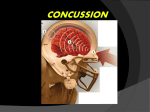 Dr Childs* PPT - Concussion Relief: Home