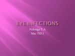 Eye infections POSA
