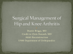 Surgical Management of Knee Arthritis