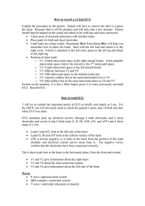 How to read ECG - Simply Psychiatry