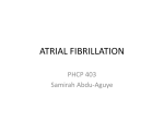 atrial fibrillation