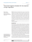 Transcranial magnetic stimulation for the treatment of major