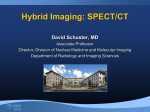Hybrid Imaging: SPECT/CT - Emory Radiology