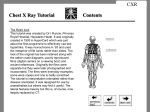 Chest XRay Tutorial