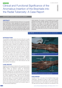 Clinical and Functional Significance of the Anomalous Insertion of