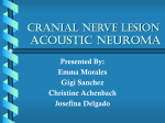 Acoustic Neuroma