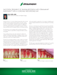 SucceSSful TreaTmenT of GinGival receSSion wiTh STraumann