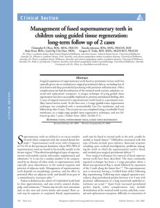 Management of fused supernumerary teeth in children using guided