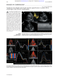 Transthoracic tissue Doppler study of right ventricular - Heart