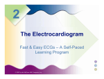 Fast and Easy ECGs, Shade / Wesley