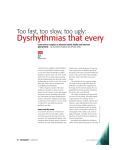 Too fast, too slow, too ugly: Dysrhythmias that every