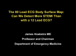 The 80 Lead ECG Body Surface Map: Can We Detect More STEMI