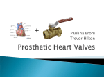 Prosthetic Heart Valves - McMaster University > ECE