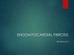endomyocardial fibrosis