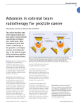 Advances in external beam radiotherapy for prostate cancer