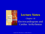 Beachey Ch 18 ECG and Cardiac Arrhythmias