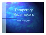 Temporary Pacemakers-2hr