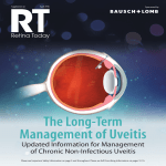 The Long-Term Management of Uveitis