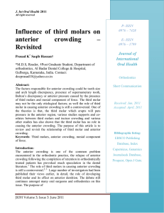 Influence of third molars on anterior crowding – Revisited