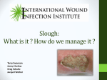 Slough: What is it and How do we manage it
