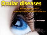 Ocular disease