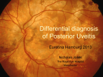 Differential diagnosis of Posterior Uveitis