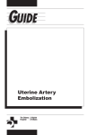 Uterine Artery Embolization