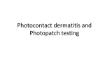 Photoallergic dermatitis and Photopatch testing