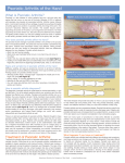 Psoriatic Arthritis of the Hand - American Society for Surgery of the