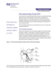 Electrophysiology Study
