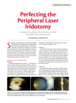 Perfecting the Peripheral Laser Iridotomy