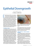Epithelial Downgrowth