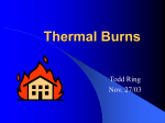 Thermal Burns