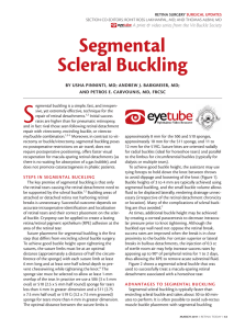 Segmental Scleral Buckling