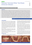 Expressly Fabricated Molar Tube Bases