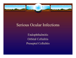 Serious Ocular Infections
