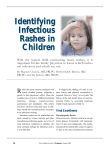 Identifying Infectious Rashes in Children Identifying Infectious
