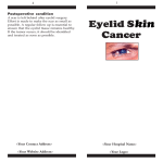 Eyelid skin cancer - VISION 2020 e