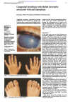 Congenital hereditary endothelial dystrophy associated with nail