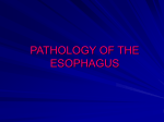 Symptoms of the esophageal disorders
