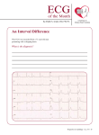 of the Month An Interval Difference