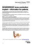 BoneBridge – bone conduction implant information for patients