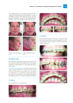 e orthodontic and surgical treatment plan must be made in