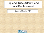 Joint Replacement Information