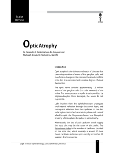 Optic Atrophy
