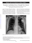 PDF - Circulation: Heart Failure