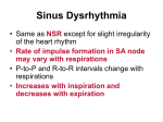 Sinus Dysrhythmia