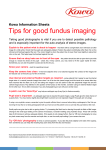 Tips for good fundus imaging